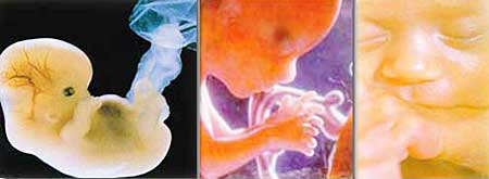 3 stages of the Human womb